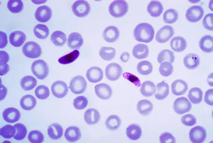 Plasmodium bersifat parasit pada manusia karena menyebabkan penyakit Malaria